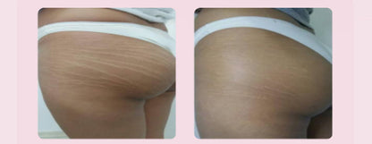 Crema ADEUS